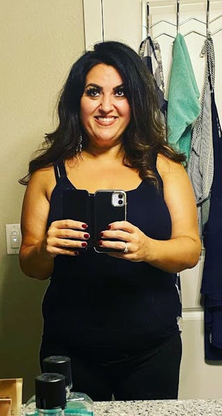 Patients 20-39 Years Old Before & After Gallery - Patient 14494180 - Image 2