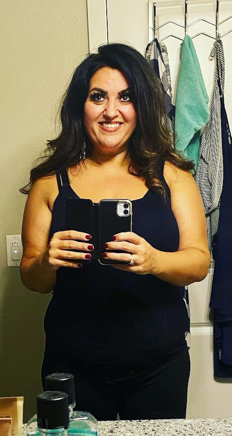 Patients 20-39 Years Old Before & After Gallery - Patient 14494180 - Image 2