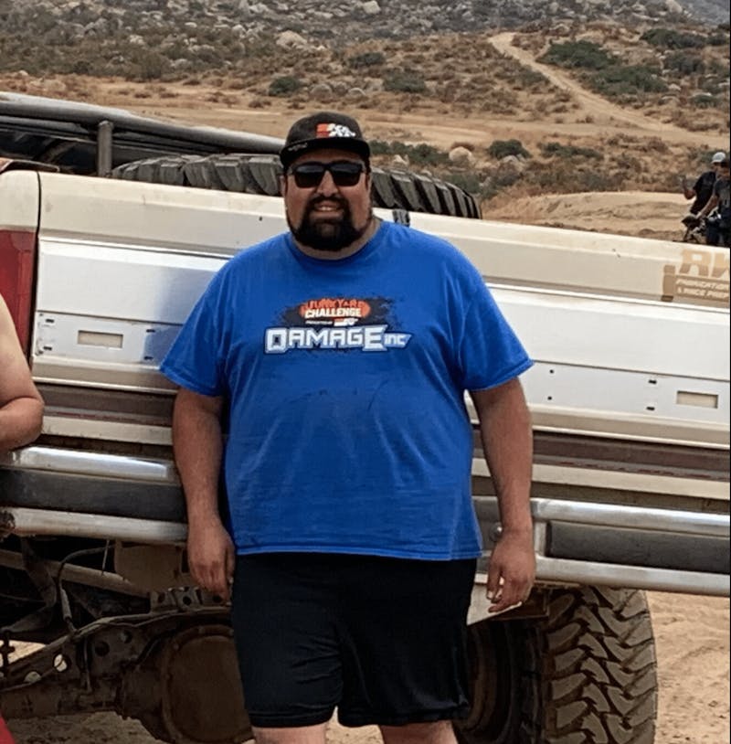 Patients 20-39 Years Old Before & After Gallery - Patient 14494183 - Image 1