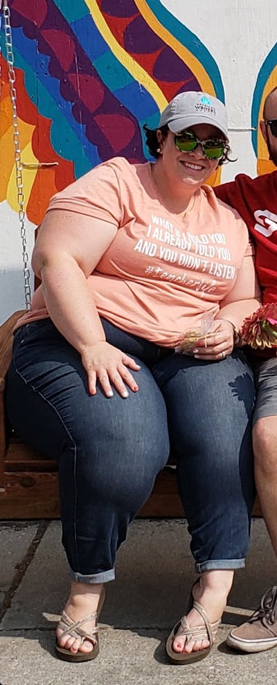 Patients 40-59 Years Old Before & After Gallery - Patient 14494184 - Image 1