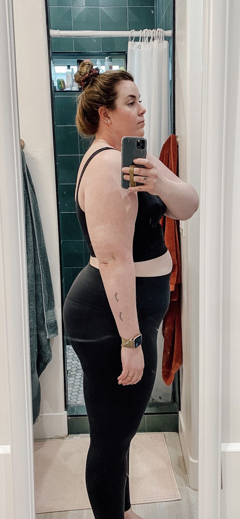 Patients 20-39 Years Old Before & After Gallery - Patient 14494186 - Image 1