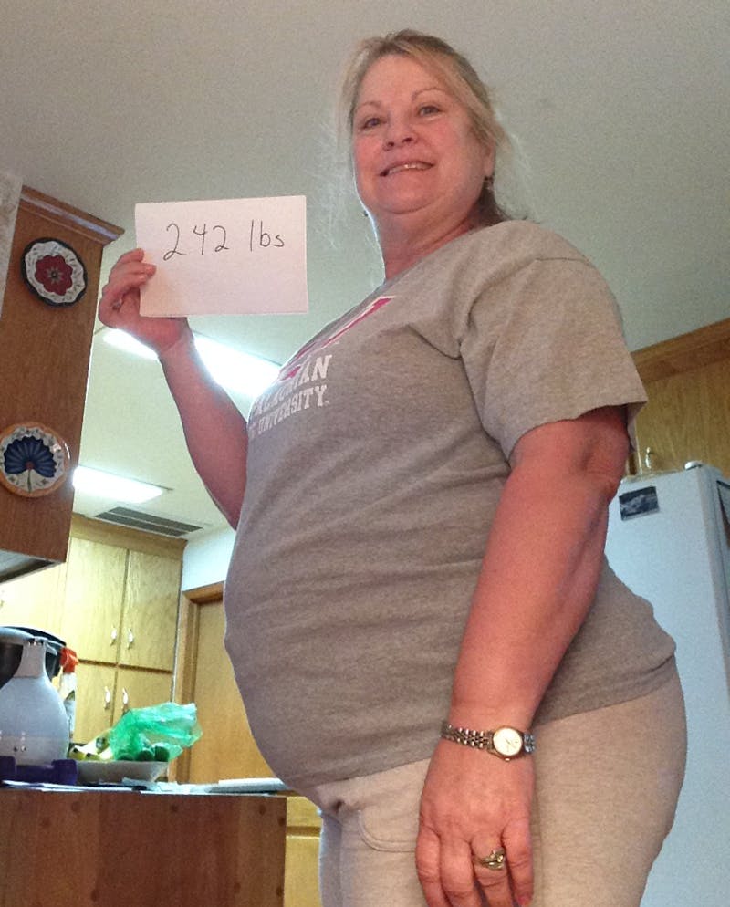 Patients 60-88 Years Old Before & After Gallery - Patient 14494188 - Image 1