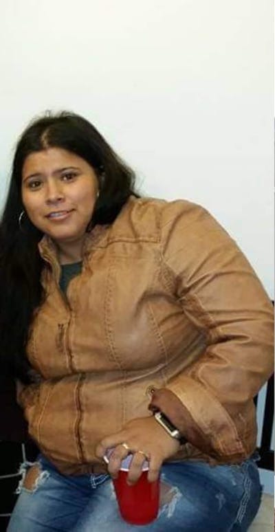 Patients 20-39 Years Old Before & After Gallery - Patient 14494187 - Image 1