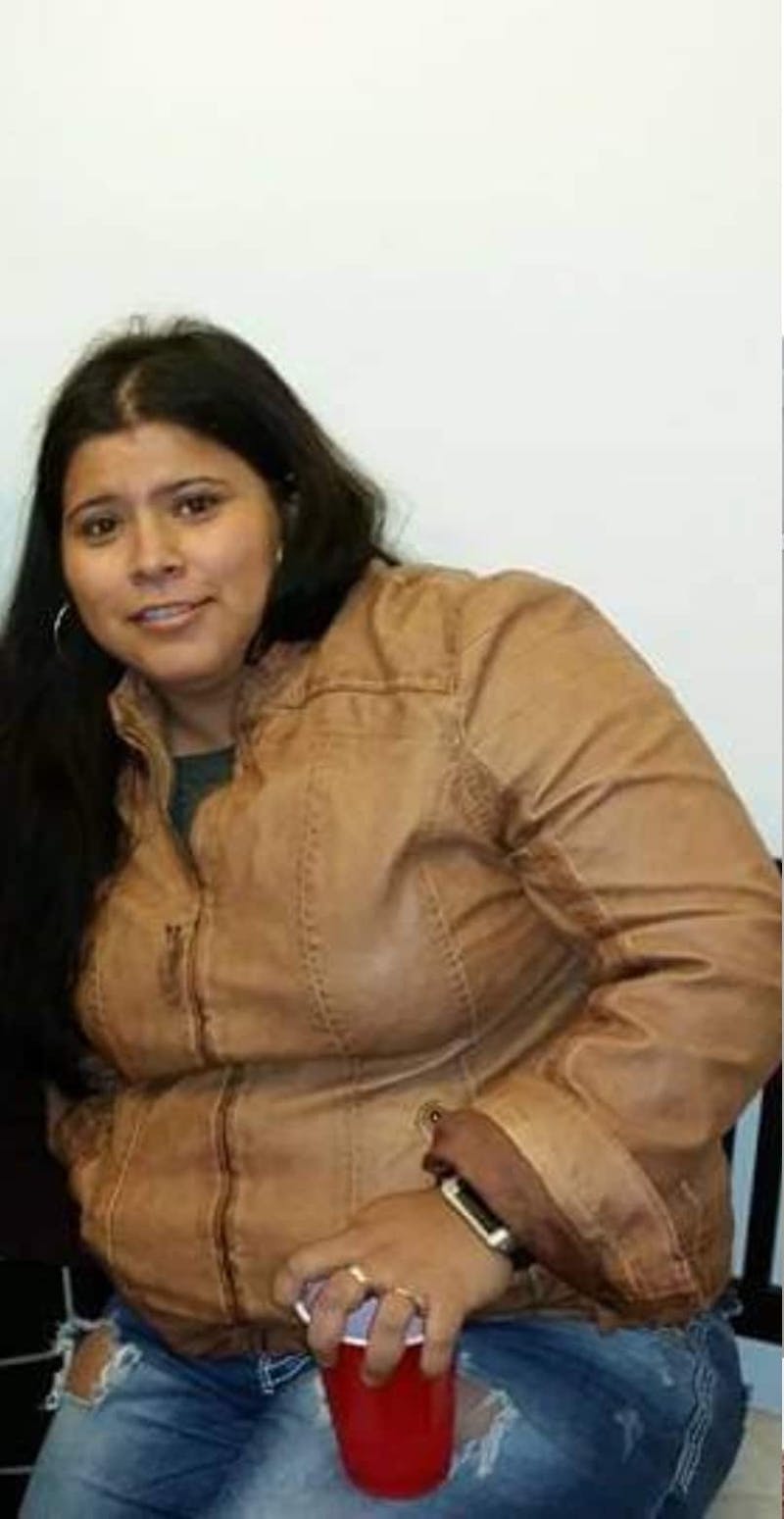 Patients 20-39 Years Old Before & After Gallery - Patient 14494187 - Image 1