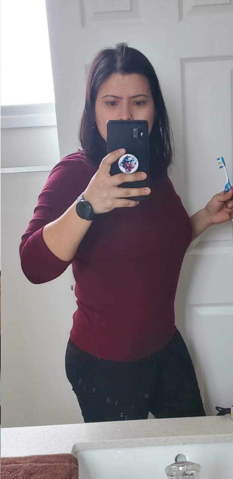 Patients 20-39 Years Old Before & After Gallery - Patient 14494187 - Image 2