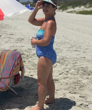 Patients 60-88 Years Old Before & After Gallery - Patient 14494188 - Image 2