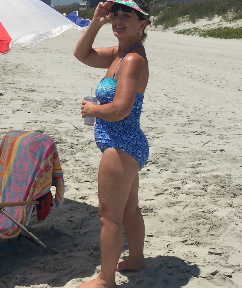 Patients 60-88 Years Old Before & After Gallery - Patient 14494188 - Image 2