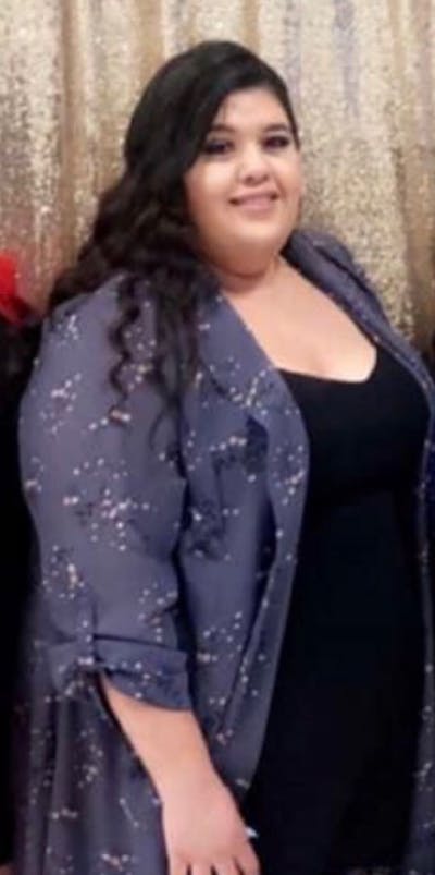 Patients 20-39 Years Old Before & After Gallery - Patient 14494190 - Image 1