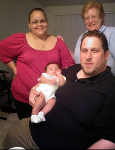 Patients 40-59 Years Old Before & After Gallery - Patient 14494195 - Image 1