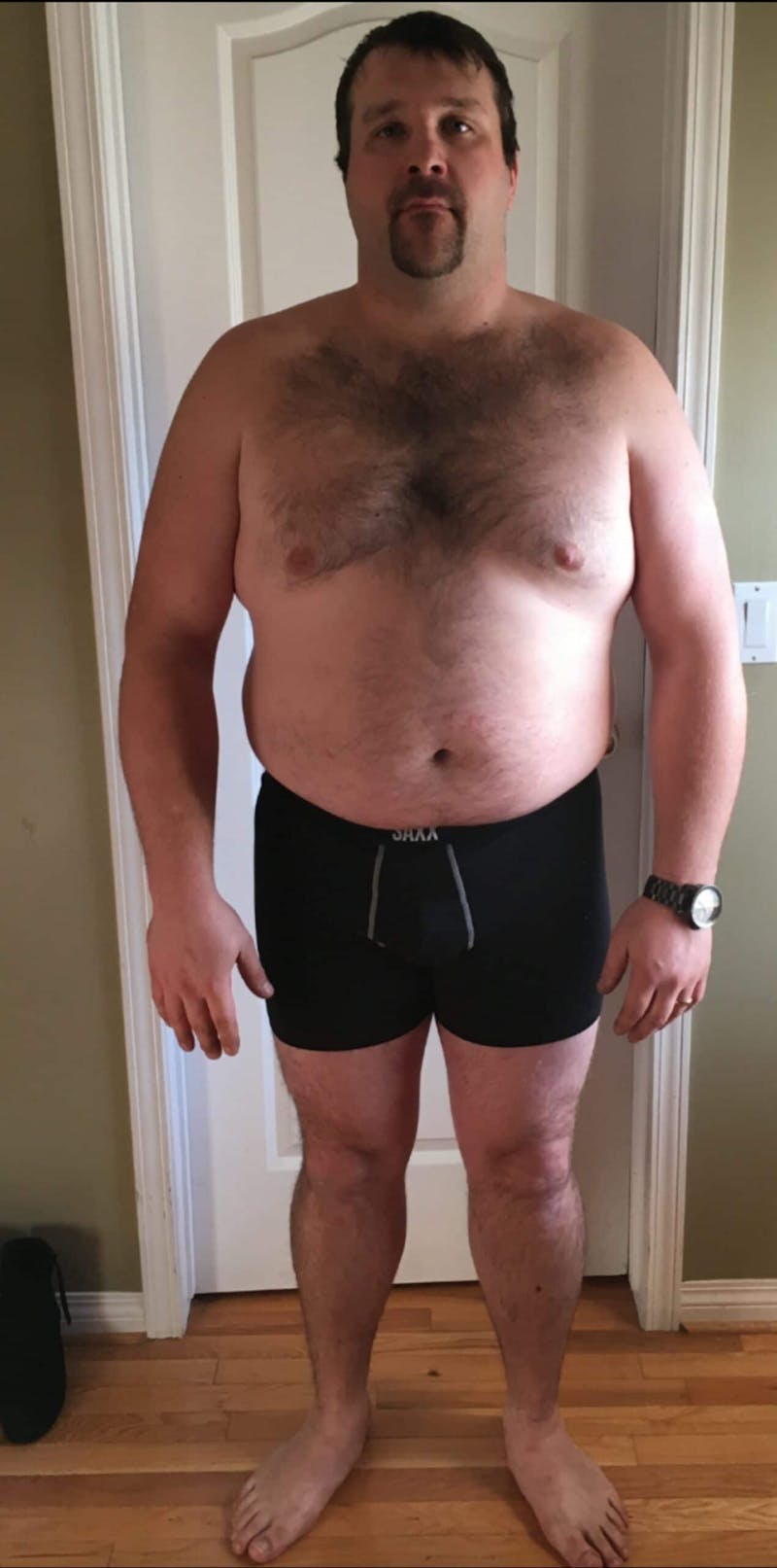 Patients 20-39 Years Old Before & After Gallery - Patient 14494194 - Image 1