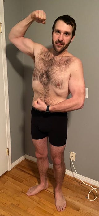 Patients 20-39 Years Old Before & After Gallery - Patient 14494194 - Image 2