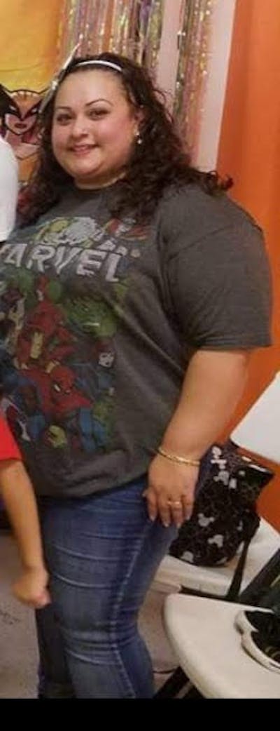 Patients 20-39 Years Old Before & After Gallery - Patient 14494197 - Image 1