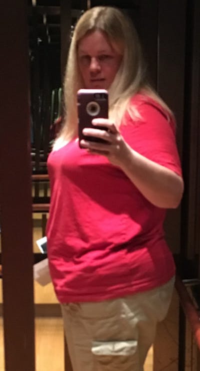 Patients 40-59 Years Old Before & After Gallery - Patient 14494199 - Image 1