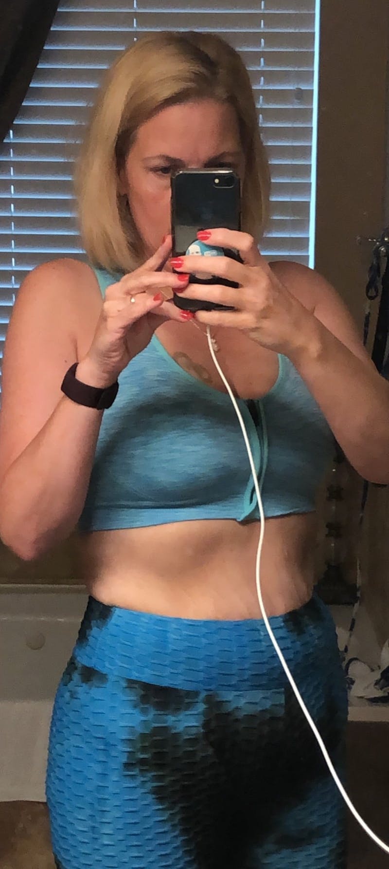 Patients 40-59 Years Old Before & After Gallery - Patient 14494199 - Image 2