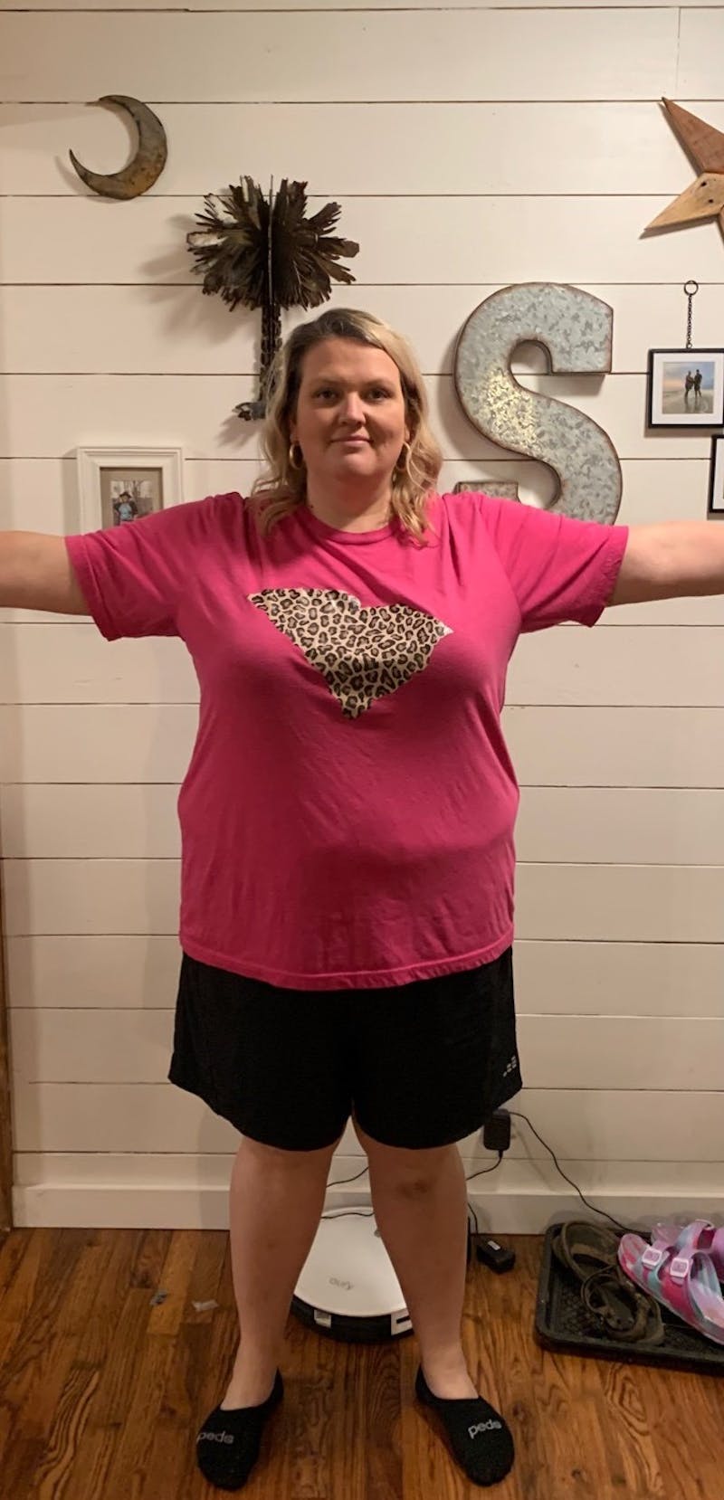 Patients 20-39 Years Old Before & After Gallery - Patient 14494200 - Image 2