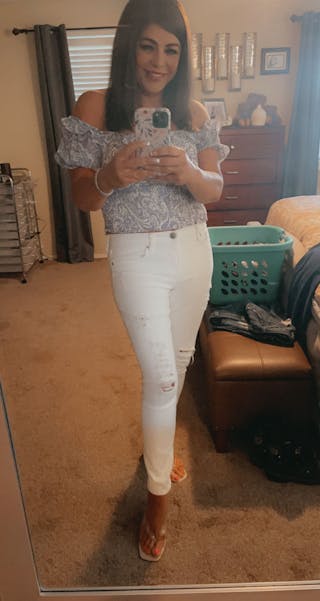 Patients 40-59 Years Old Before & After Gallery - Patient 14494202 - Image 2