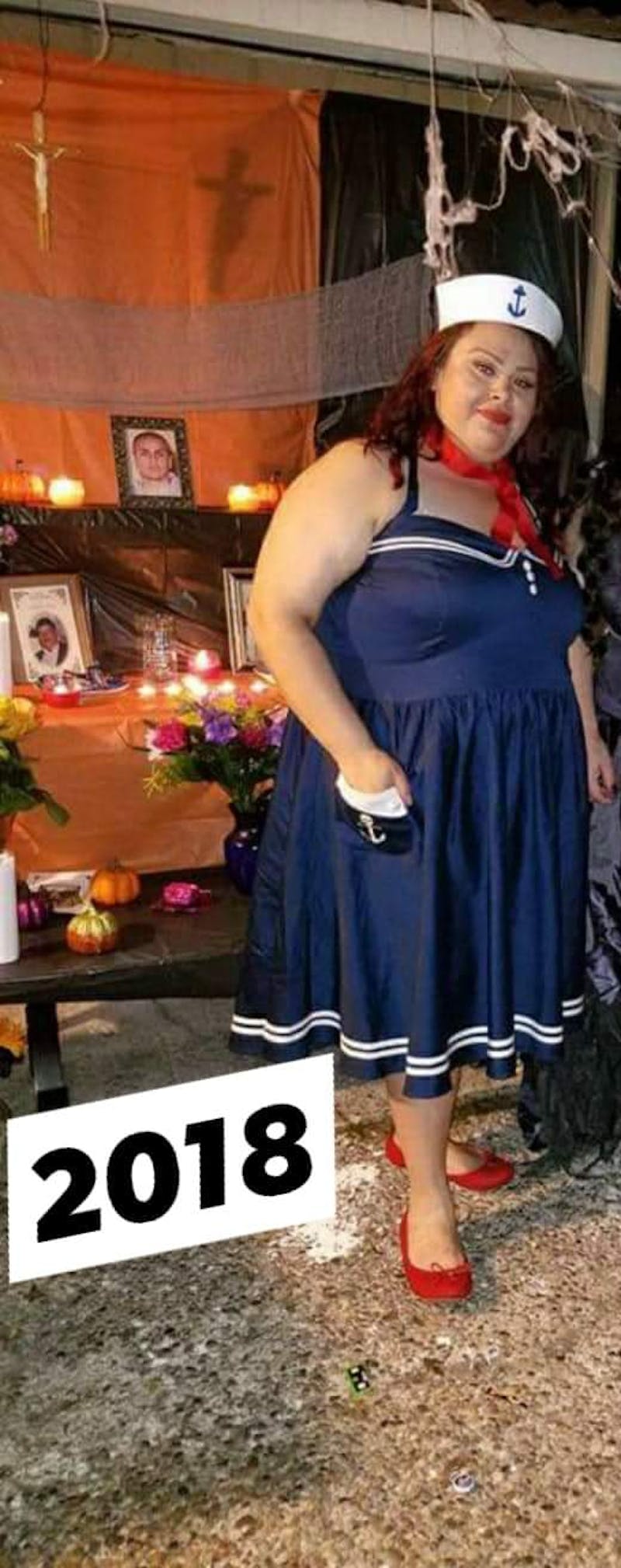 Patients 20-39 Years Old Before & After Gallery - Patient 14494203 - Image 1