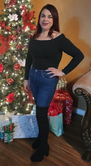 Patients 20-39 Years Old Before & After Gallery - Patient 14494203 - Image 2