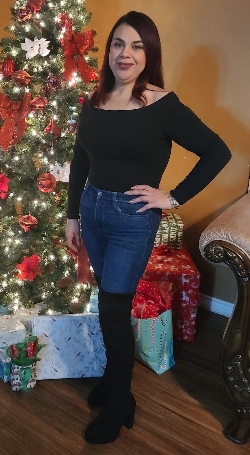 Patients 20-39 Years Old Before & After Gallery - Patient 14494203 - Image 2