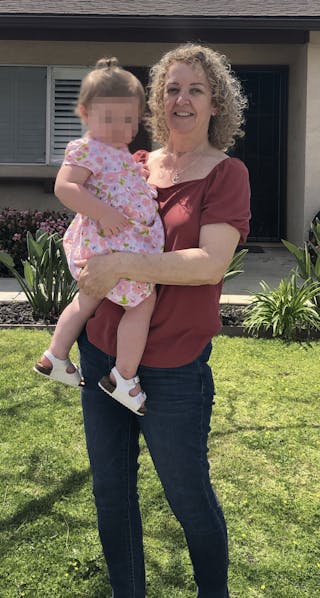 Patients 40-59 Years Old Before & After Gallery - Patient 14494204 - Image 2