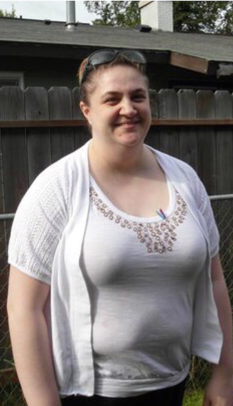 Patients 20-39 Years Old Before & After Gallery - Patient 14494205 - Image 1