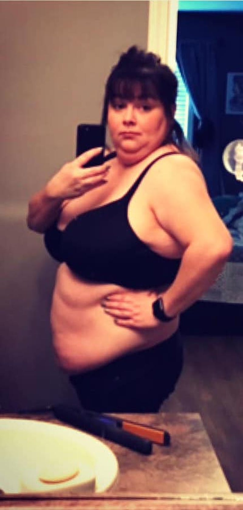 Patients 20-39 Years Old Before & After Gallery - Patient 14494207 - Image 1