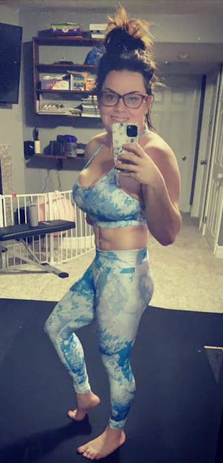 Patients 20-39 Years Old Before & After Gallery - Patient 14494207 - Image 2