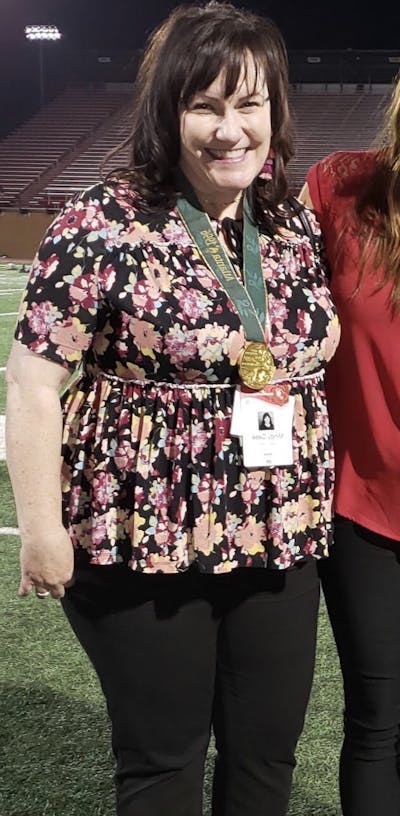 Patients 40-59 Years Old Before & After Gallery - Patient 14494210 - Image 1