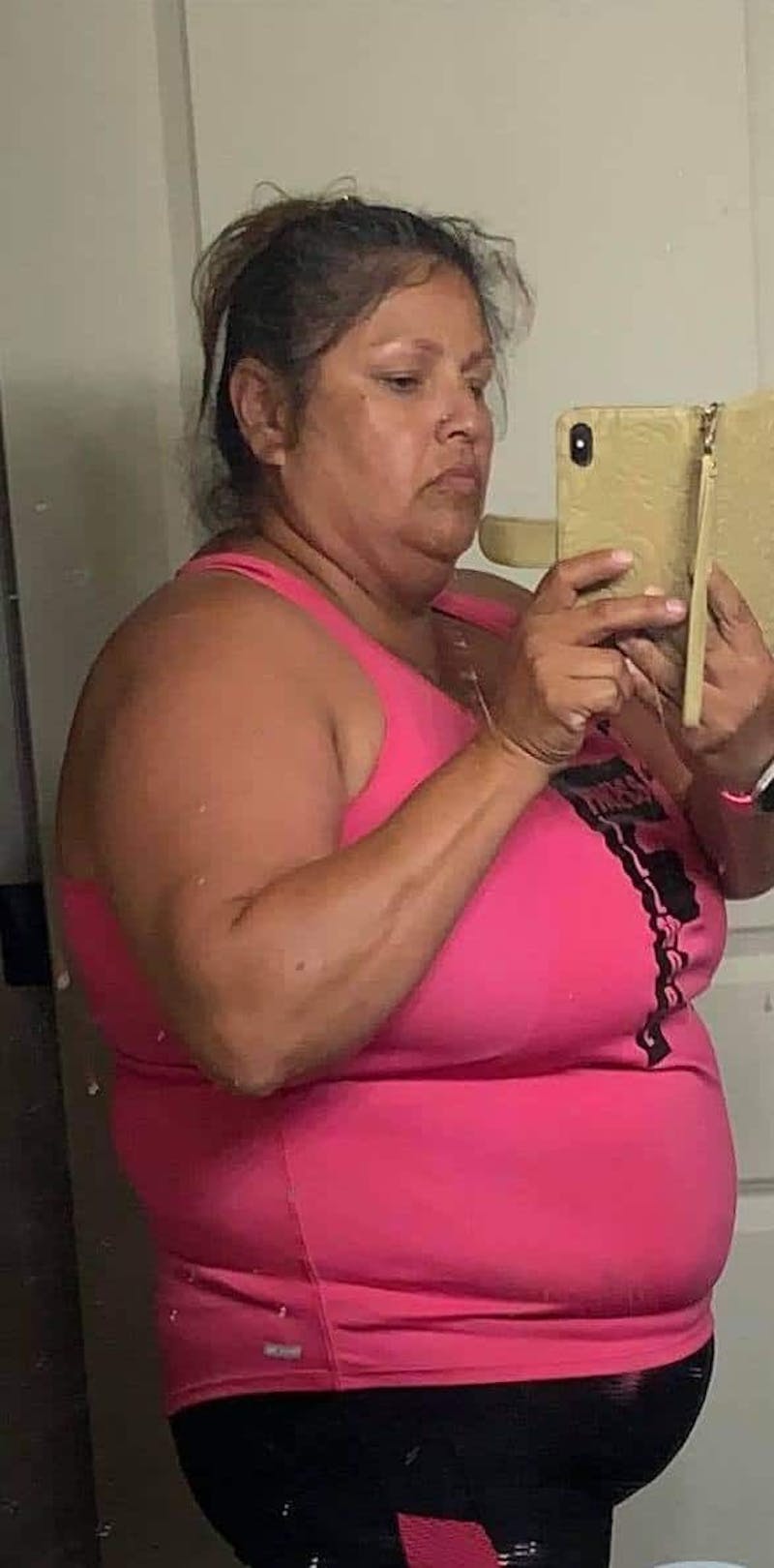 Patients 40-59 Years Old Before & After Gallery - Patient 14494211 - Image 1