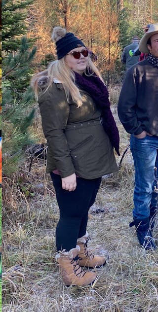 Patients 20-39 Years Old Before & After Gallery - Patient 14494212 - Image 2