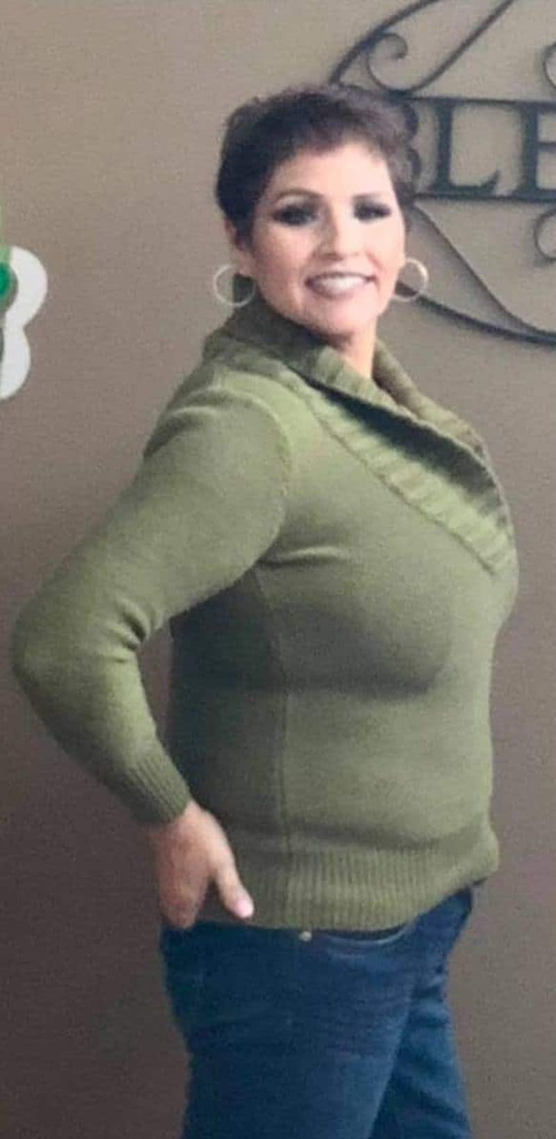 Patients 40-59 Years Old Before & After Gallery - Patient 14494211 - Image 2