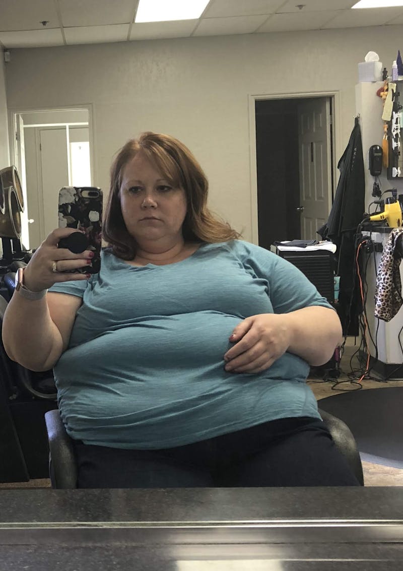 Patients 20-39 Years Old Before & After Gallery - Patient 14494228 - Image 1