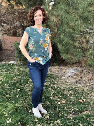 Patients 20-39 Years Old Before & After Gallery - Patient 14494228 - Image 2