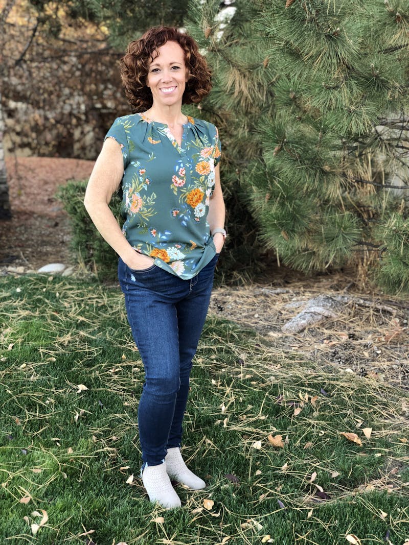 Patients 20-39 Years Old Before & After Gallery - Patient 14494228 - Image 2