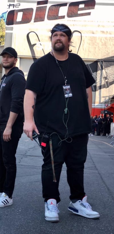 Patients 20-39 Years Old Before & After Gallery - Patient 14494230 - Image 1