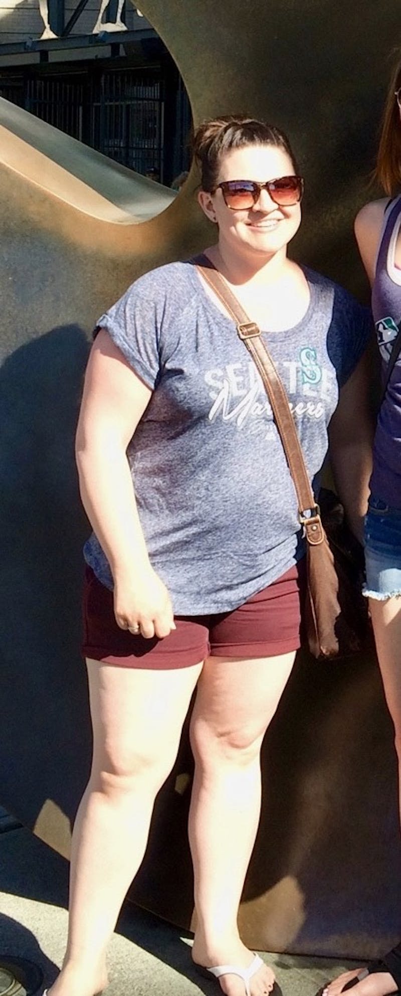 Patients 20-39 Years Old Before & After Gallery - Patient 14494232 - Image 1