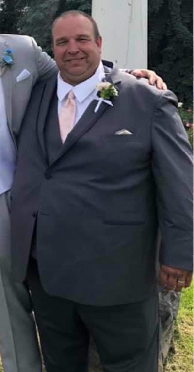 Patients 40-59 Years Old Before & After Gallery - Patient 14494233 - Image 1