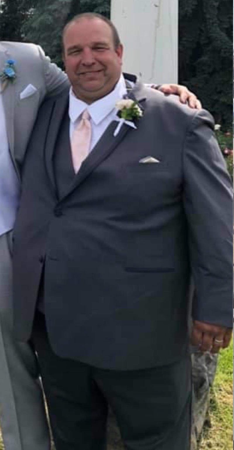 Patients 40-59 Years Old Before & After Gallery - Patient 14494233 - Image 1