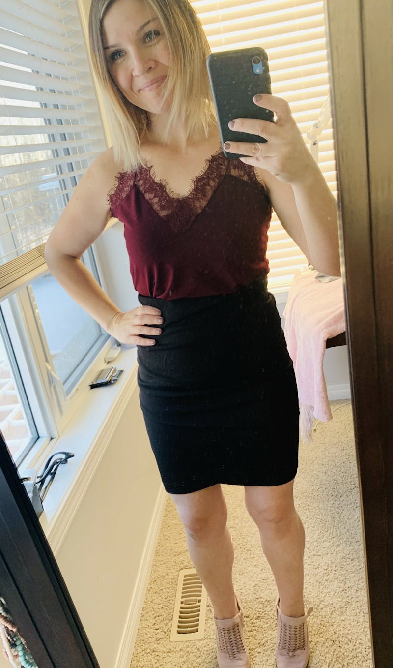 Patients 20-39 Years Old Before & After Gallery - Patient 14494232 - Image 2