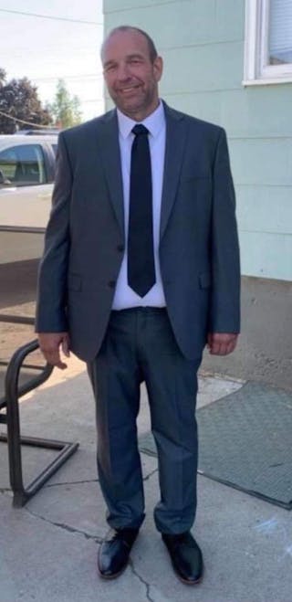 Patients 40-59 Years Old Before & After Gallery - Patient 14494233 - Image 2