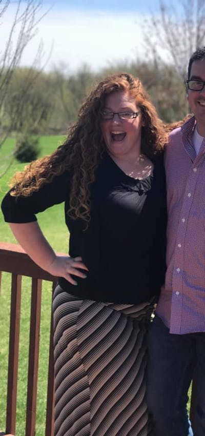 Patients 20-39 Years Old Before & After Gallery - Patient 14494234 - Image 1