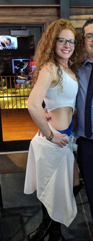 Patients 20-39 Years Old Before & After Gallery - Patient 14494234 - Image 2