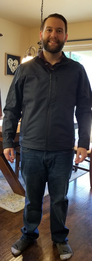 Patients 20-39 Years Old Before & After Gallery - Patient 14494237 - Image 2