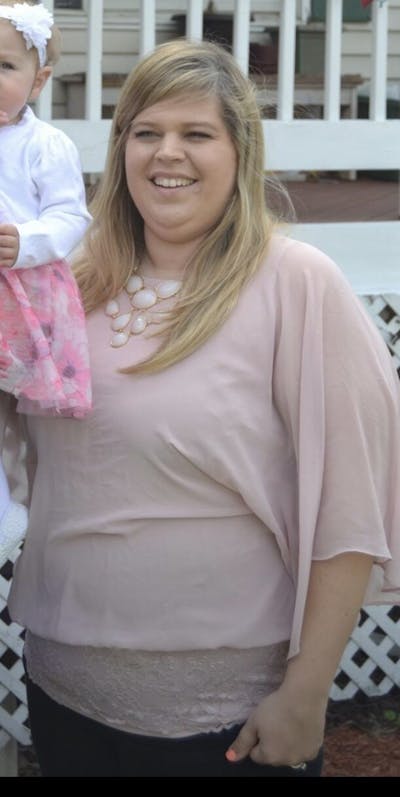 Patients 20-39 Years Old Before & After Gallery - Patient 14494239 - Image 1