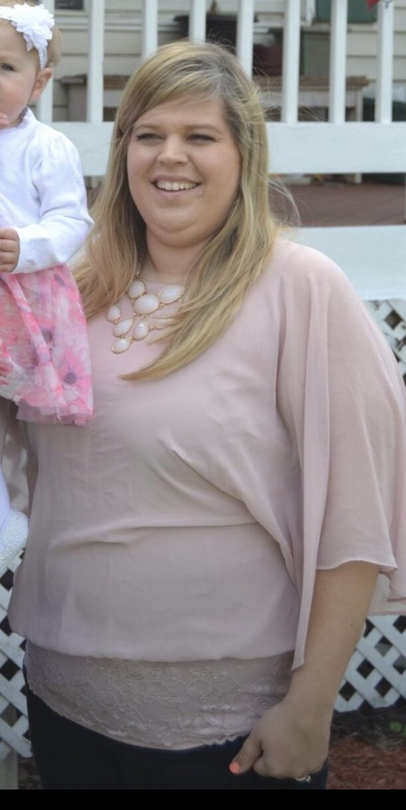 Patients 20-39 Years Old Before & After Gallery - Patient 14494239 - Image 1