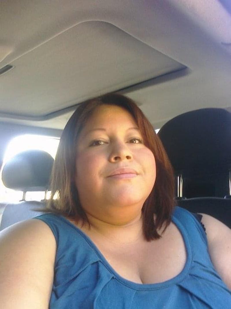 Patients 20-39 Years Old Before & After Gallery - Patient 14494241 - Image 1