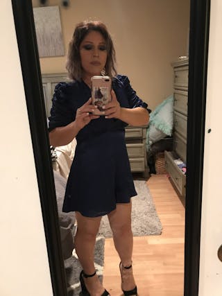 Patients 20-39 Years Old Before & After Gallery - Patient 14494241 - Image 2