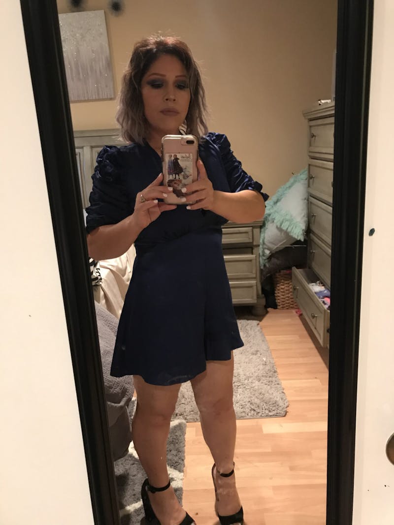 Patients 20-39 Years Old Before & After Gallery - Patient 14494241 - Image 2