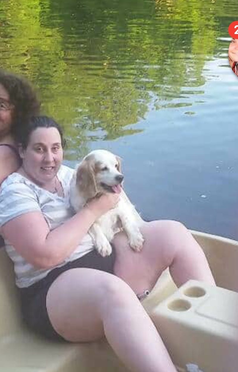 Patients 20-39 Years Old Before & After Gallery - Patient 14494246 - Image 1