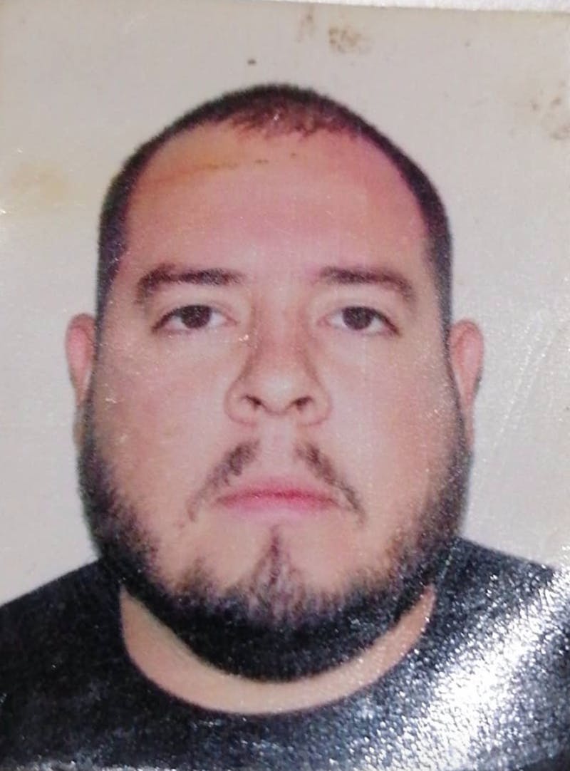 Patients 20-39 Years Old Before & After Gallery - Patient 14494249 - Image 1